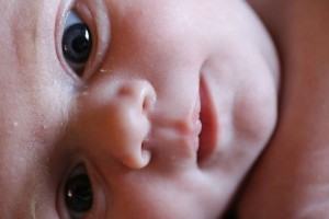 一个月婴儿黄疸正常值是多少新生儿黄疸的居家护理