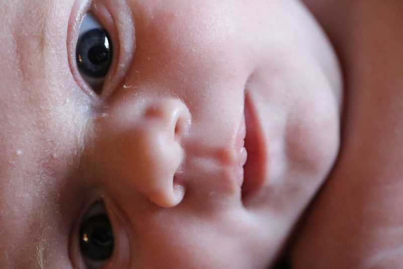 一个月婴儿黄疸正常值是多少新生儿黄疸的居家护理